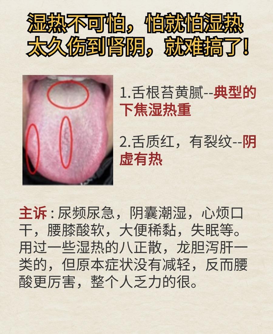湿热不可怕，怕的是热盛伤阴，阴虚＋湿热，就难搞了