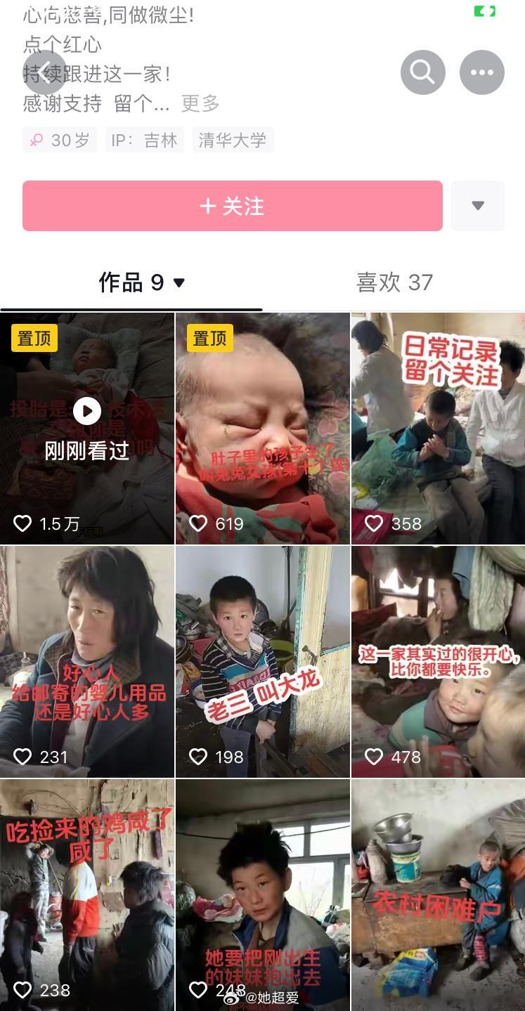 这个叫兔兔的小女孩太可怜了，她才刚出生没多久腋下都捂烂了，腋下都烂成这样h胯下更