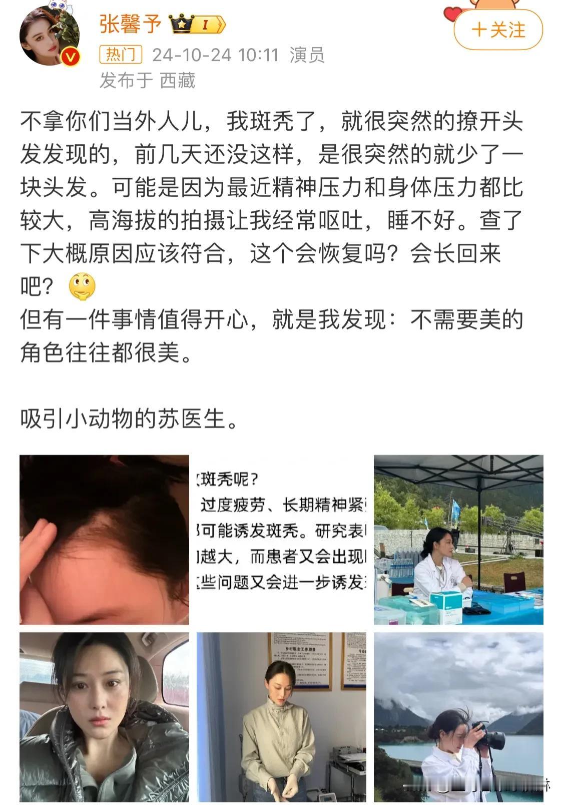 #张馨予 斑秃#
张馨予也快四十岁了，其中这个年纪脱发挺正常的，很多比她年轻的都