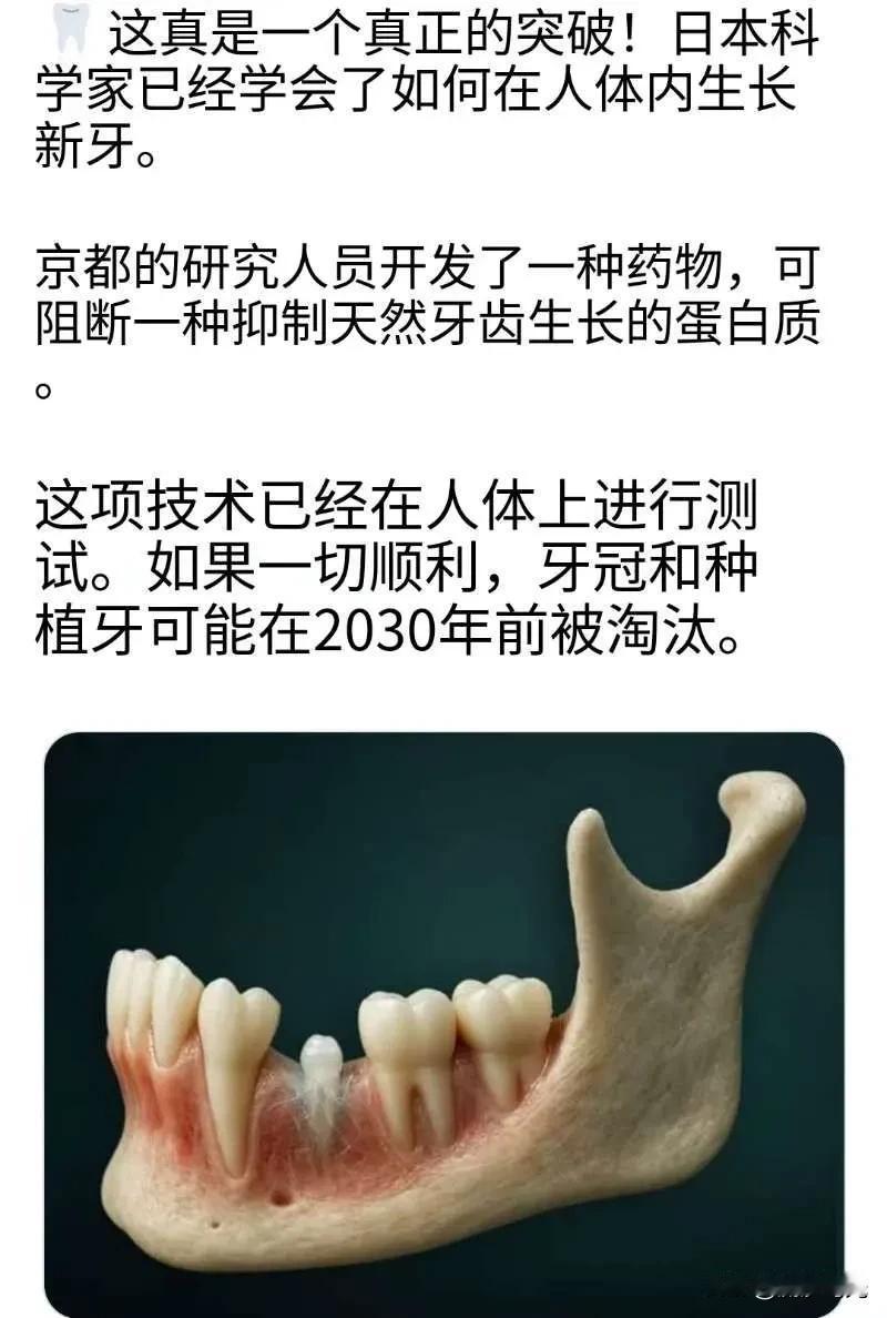 日本科学家已经掌握了在人体内培育新牙齿的方法。 京都的研究人员研发出一种药物，能