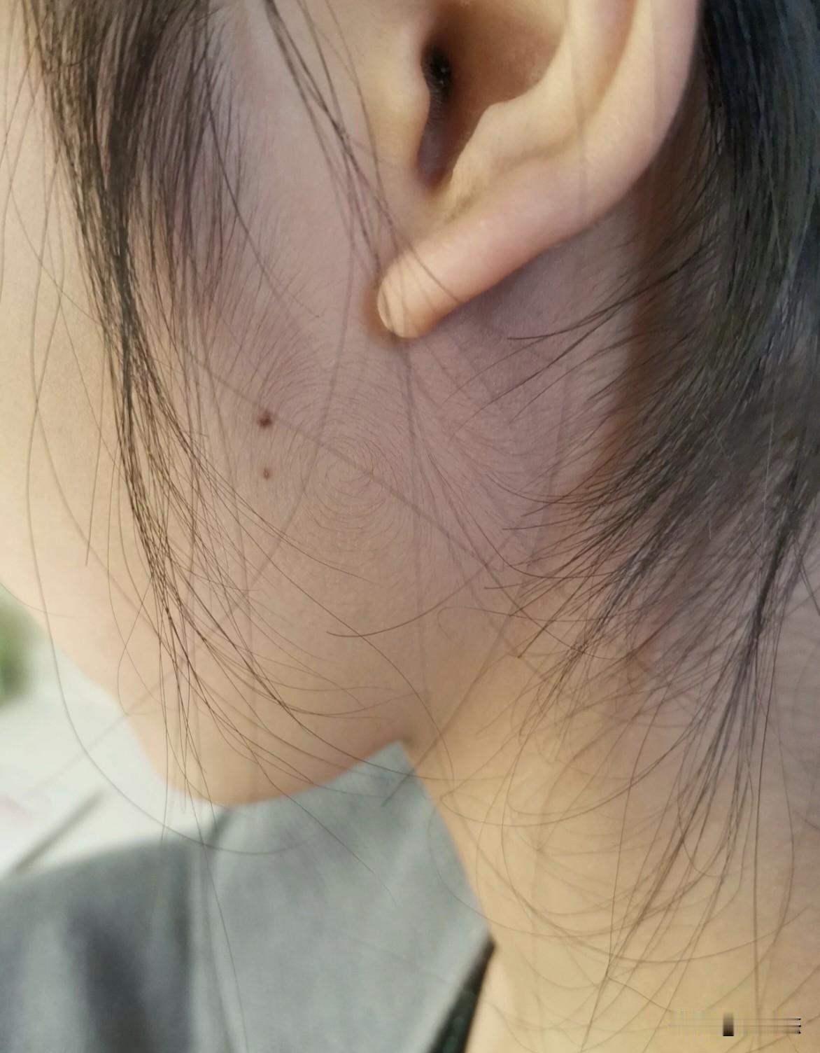 脸上的漩涡，这代表什么？