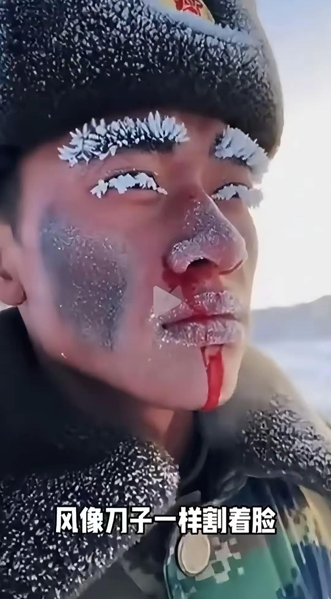 泪目了！
看的好心疼！
十八，九岁的年纪，本该在父母面前撒娇的孩子，却扛下守护祖