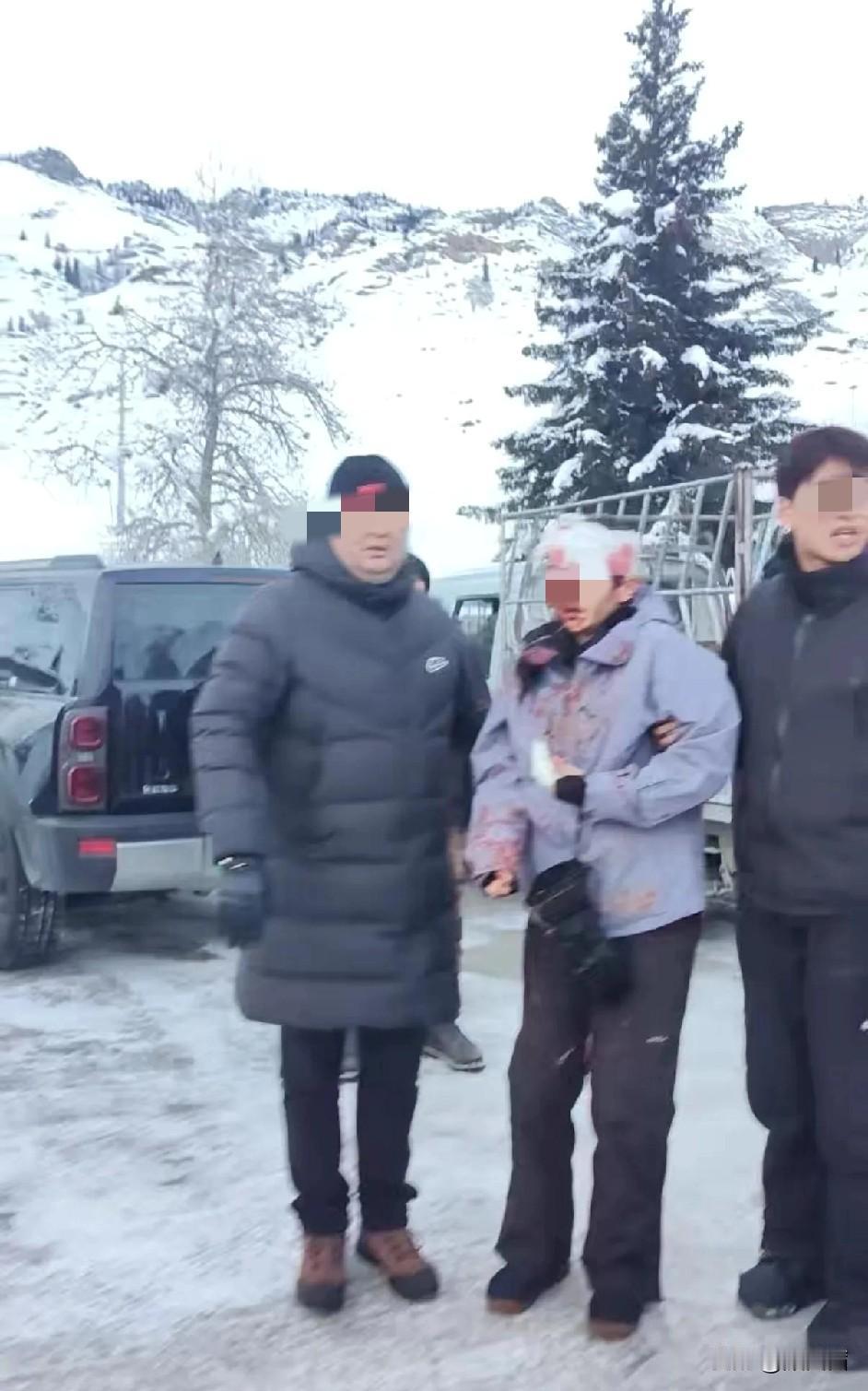 可可托海雪豹突袭游客！伤者满脸血渍，景区早发预警仍酿悲剧
可可托海突发雪豹伤人事