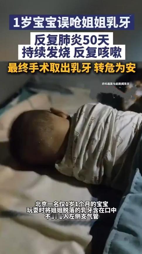 揪心！一颗乳牙，差点要了1岁宝宝的命。
 
北京这家医院接诊的案例，让所有家长后