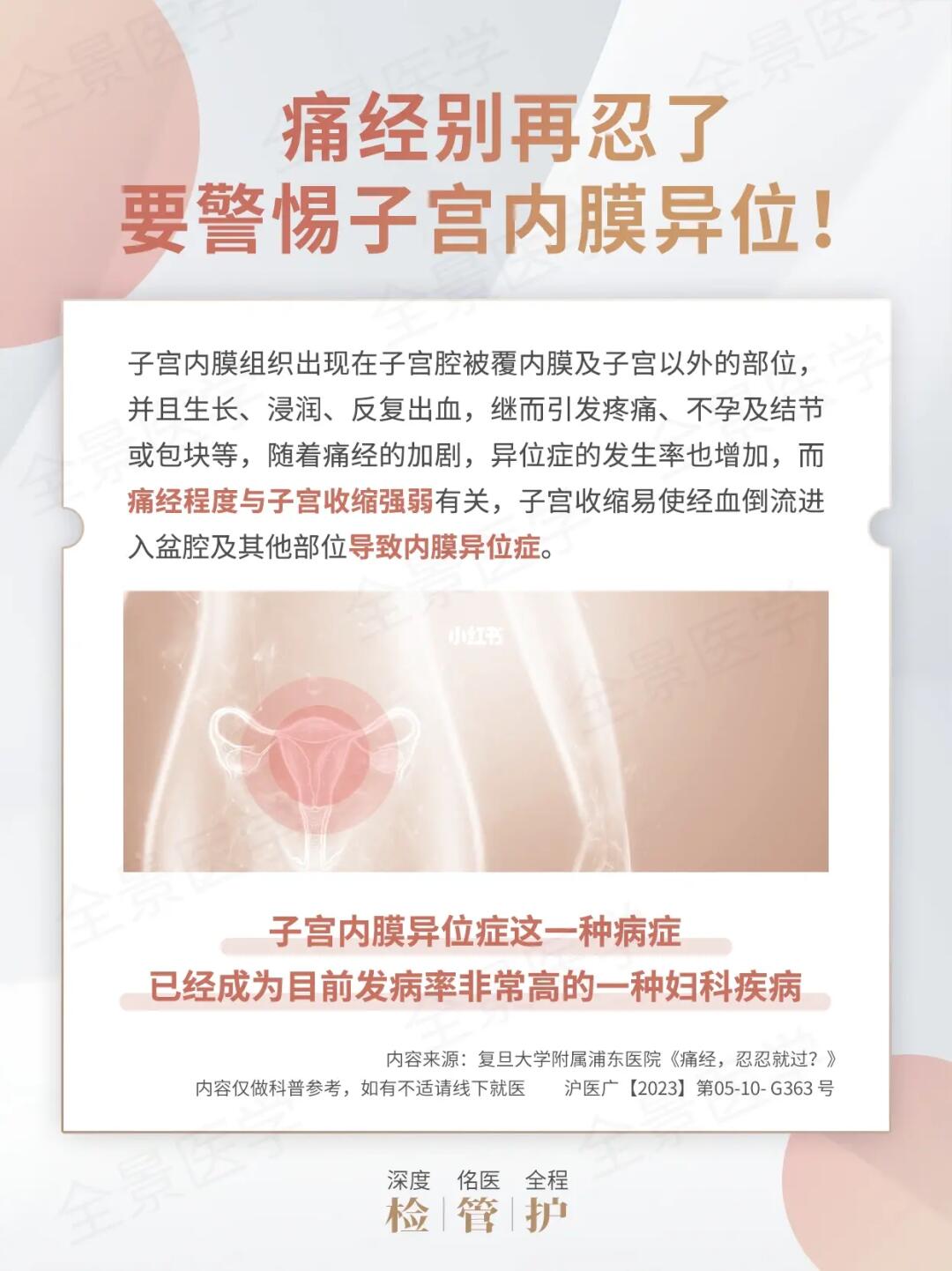 痛经别再忍了，要警惕子宫内膜异位❌