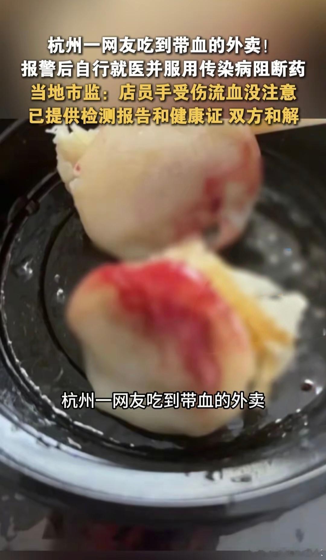 外卖餐食中有血迹顾客紧急服阻断药 最好叫上老板，去医院做个传染病检查，老板如果不