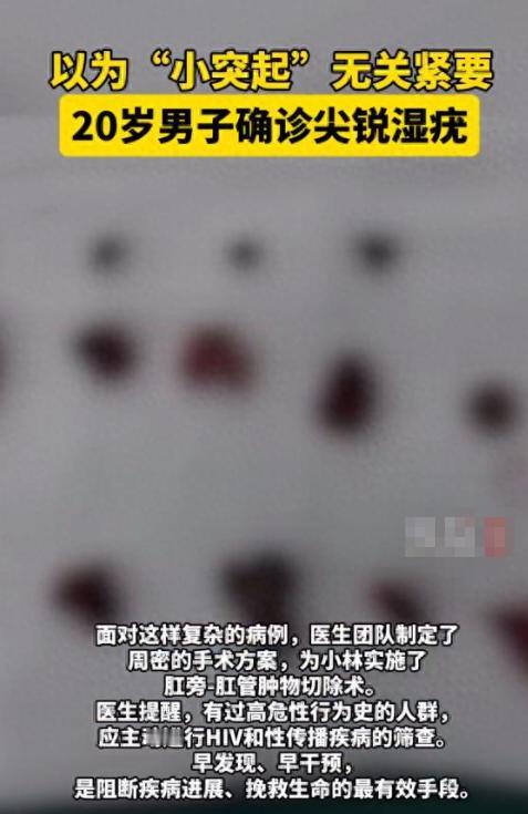 “这就是放纵的后果！”福建漳州，一20岁小伙，突然发现肛周长出很多“肉疙瘩”，不