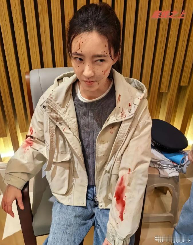 王丽坤这是怎么了，剧里被家暴了了吗？她真不愧是是素颜女神，，40多岁了皮肤还是那