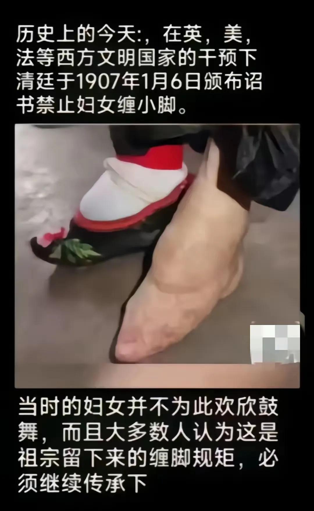 古代缠足真的太灭绝人性了，太残忍了。
我好奇，当时慈禧有没有缠足？
