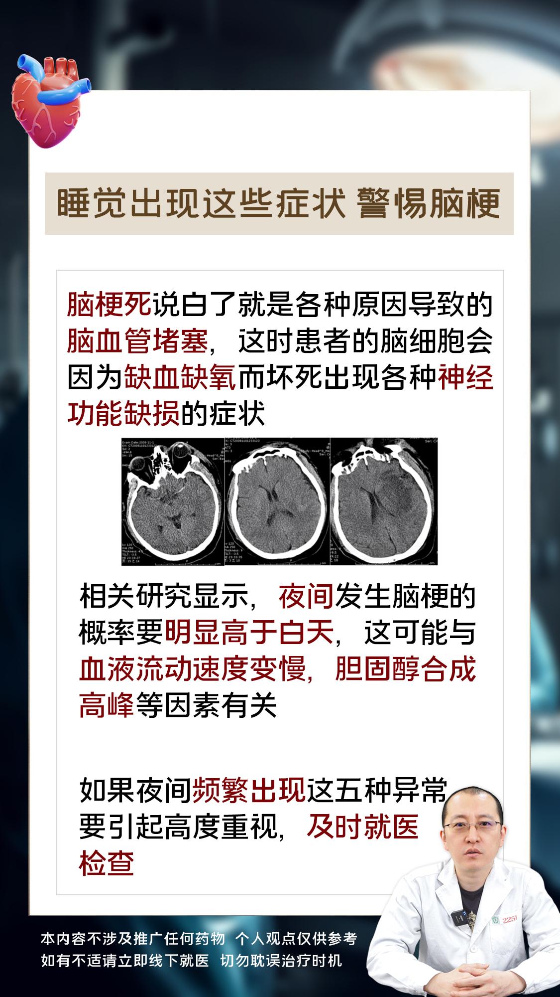 睡觉出现这些症状，警惕脑梗。