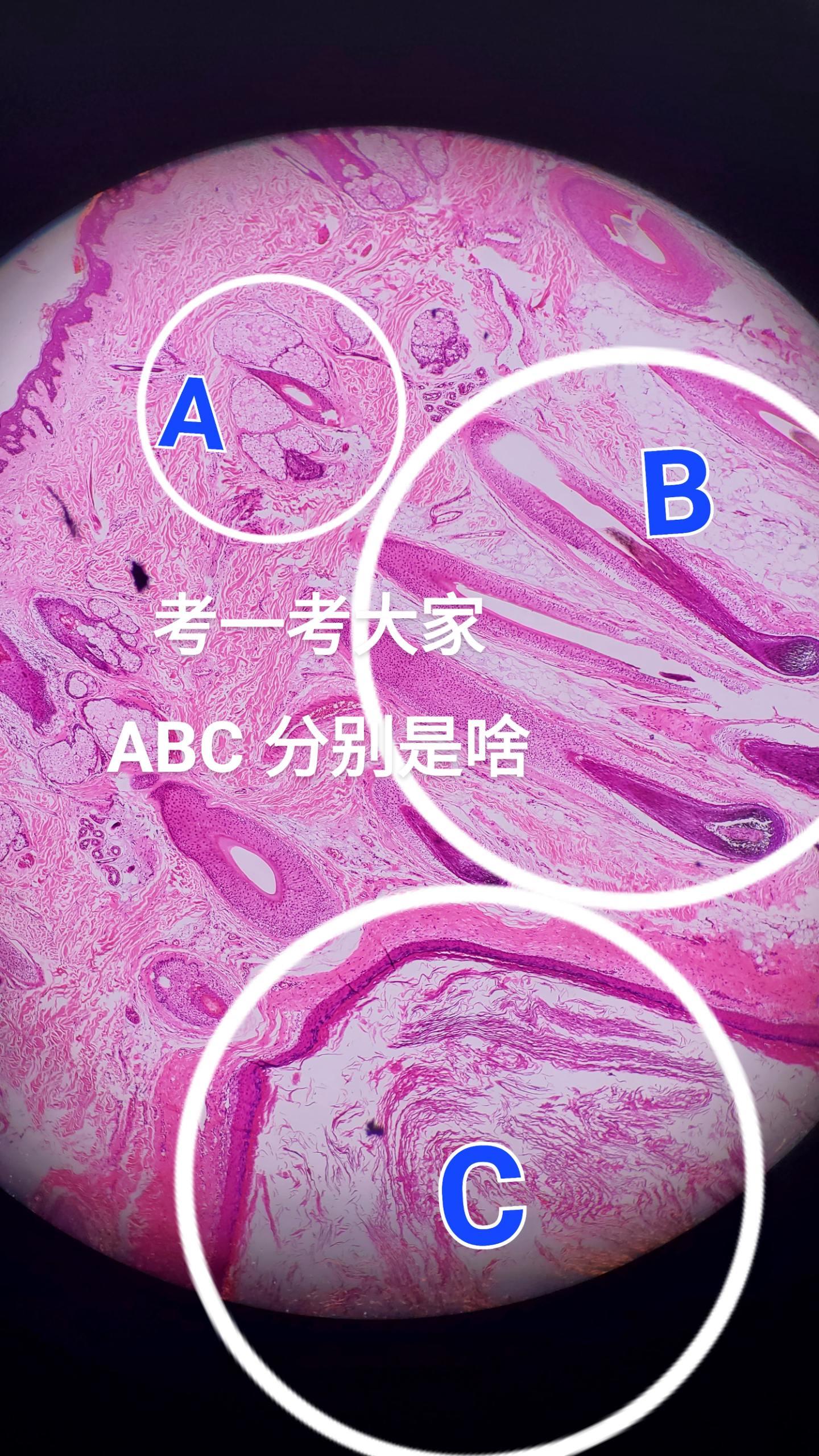 皮肤肿块
