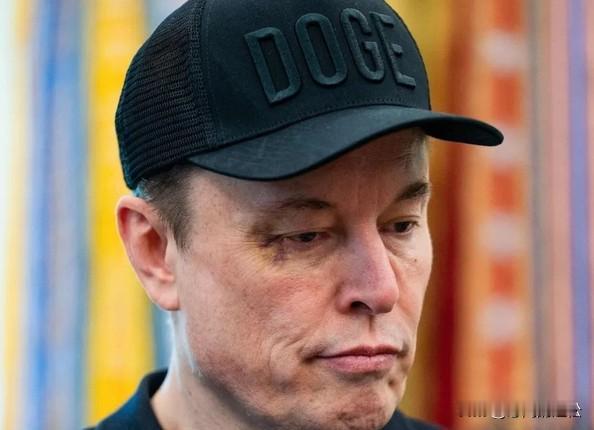 如果马斯克眼眶发青真是贝森特造成的，那马斯克也太逊了，中年人都没斗过这位老年大叔