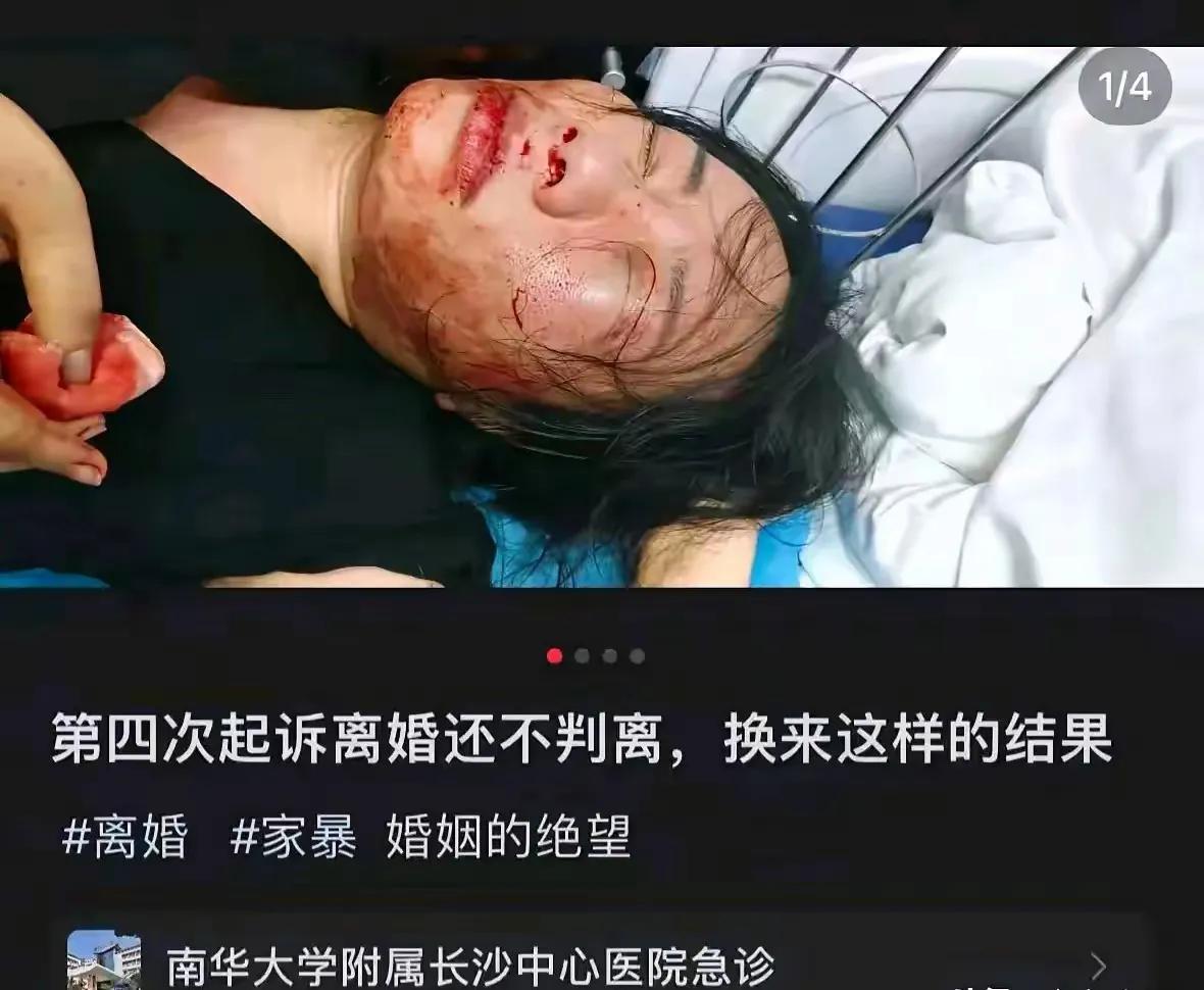 #婚姻里的残酷真相#一女子因为她老公家暴，四次提出离婚都被法院驳回，离不了！已经
