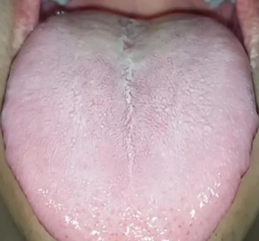 血瘀只知道用血府逐瘀，不仅白花钱还没效果，其实只需再加一个方就能彻底清除全身血瘀