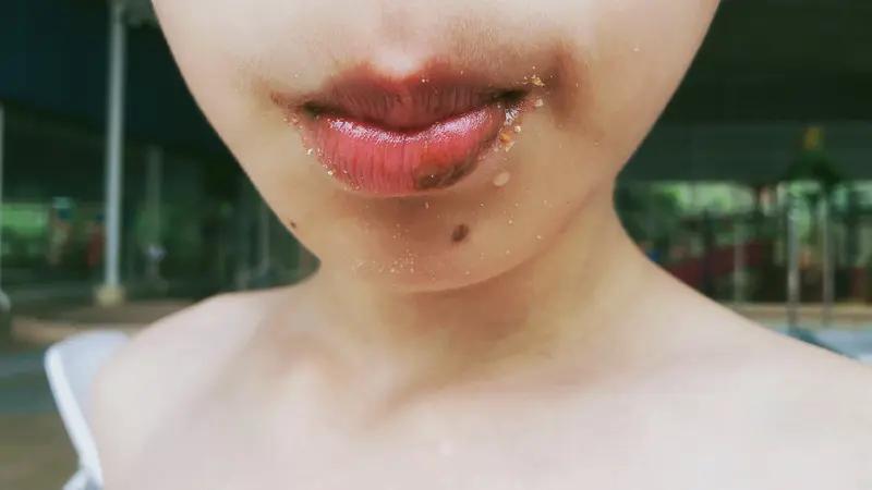 女子嘴角起泡未重视竟脑死亡 看到女子嘴角起泡未重视竟脑死亡这个话题，真的惊掉下巴