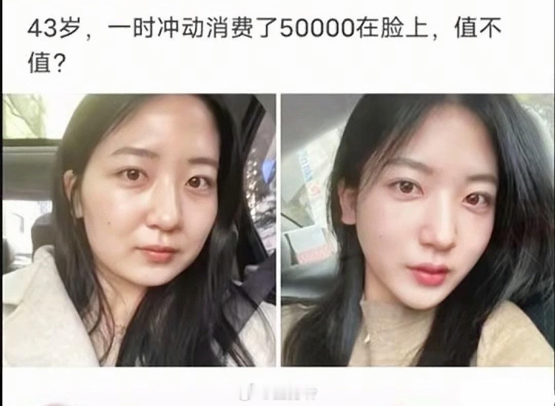 43岁，一时冲动消费了50000在脸上，值不值？ 