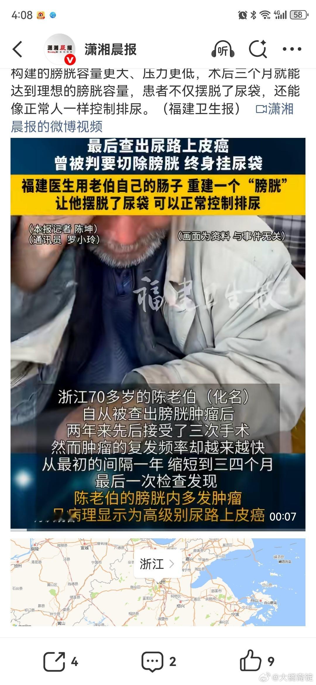 医生为癌症男子做了新膀胱膀胱尿路上皮癌，早期可以通过经尿道电切手术治疗，如果没有