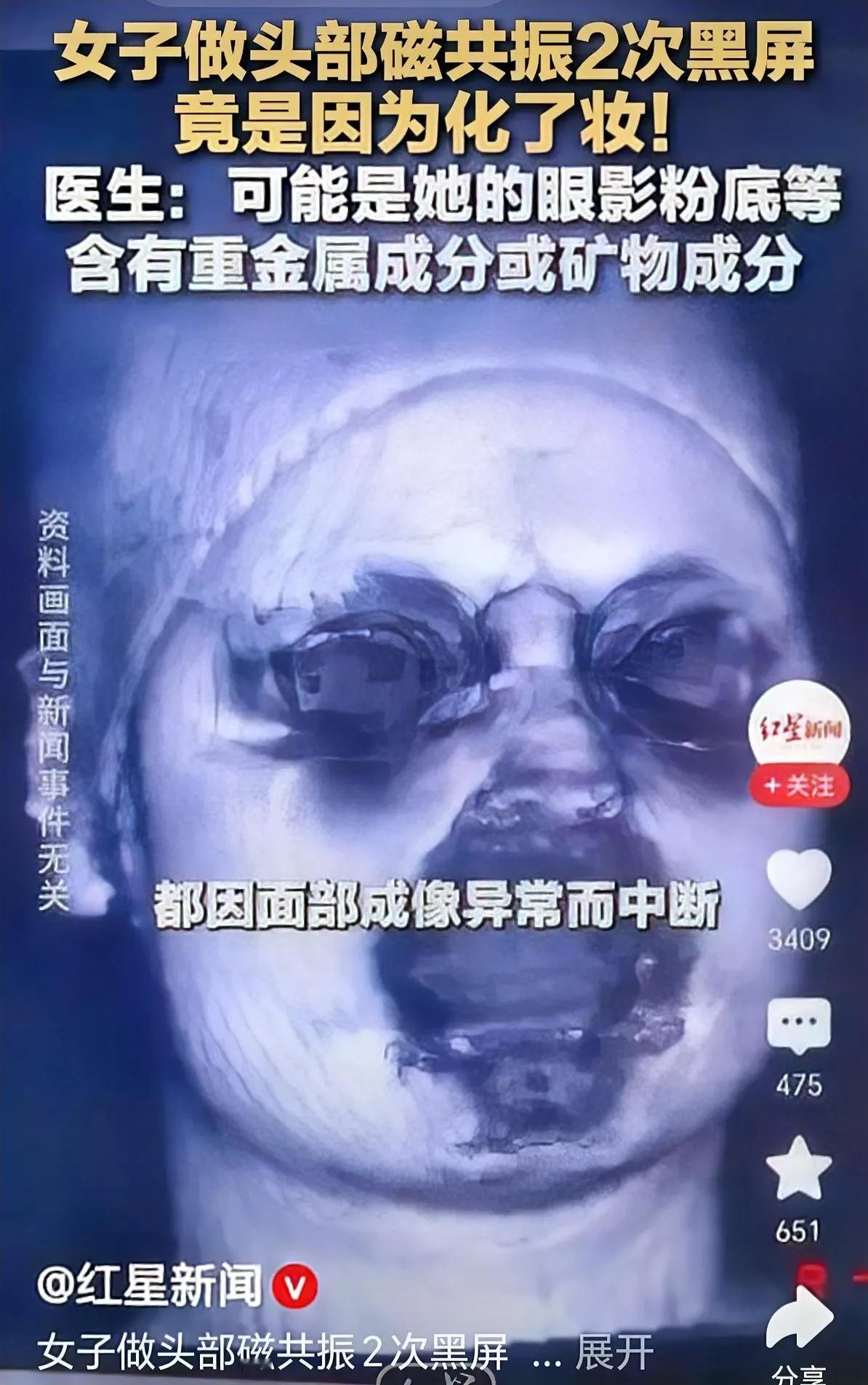 记住了！[白眼]
照核磁，要先洗脸！

网络新闻，说一名女子去医院照头部核磁共振