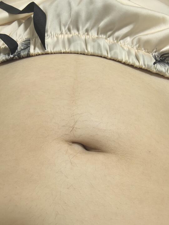 15周＋2天，长毛毛了，腹白线也黑了