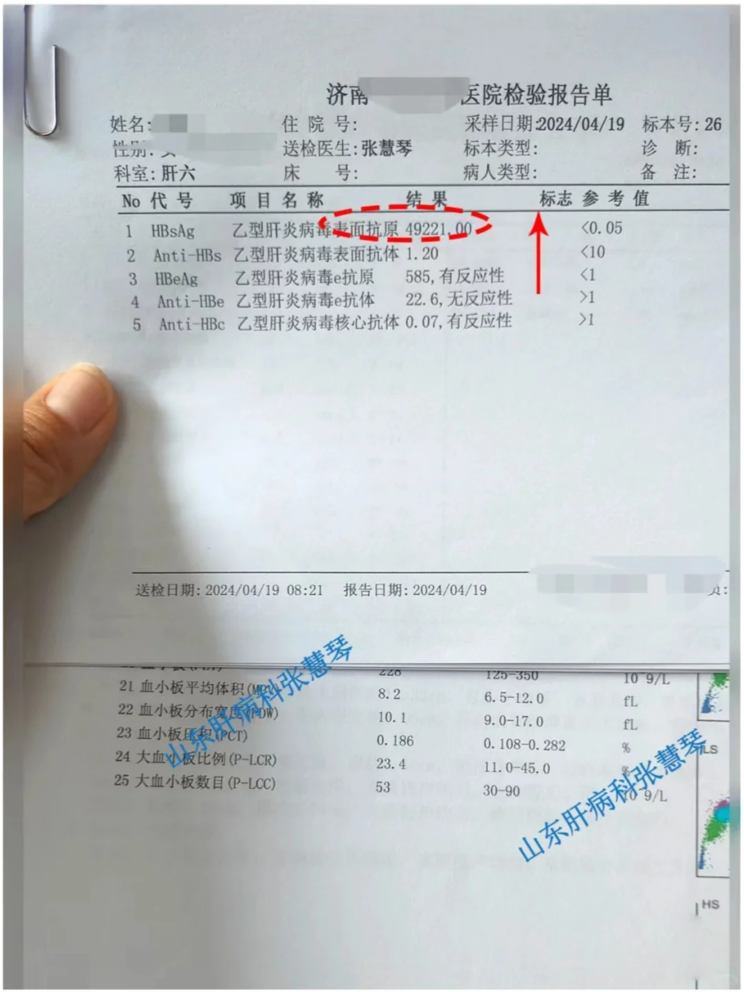 乙肝表面抗原4万9，这几个危害不得不知！