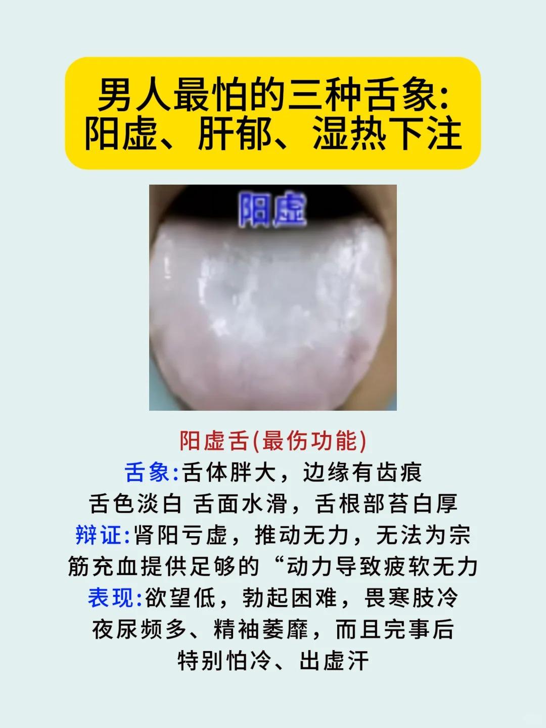 男人最怕的三种舌象：阳虚、肝郁、湿热下注！