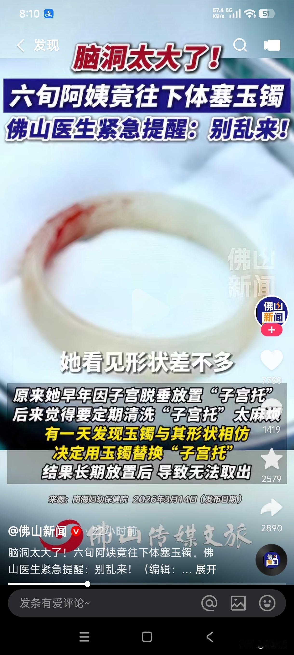 6旬阿姨居然往下体塞玉镯无法取出紧急就医

原来她早年因子宫脱垂放置子宫托，后来