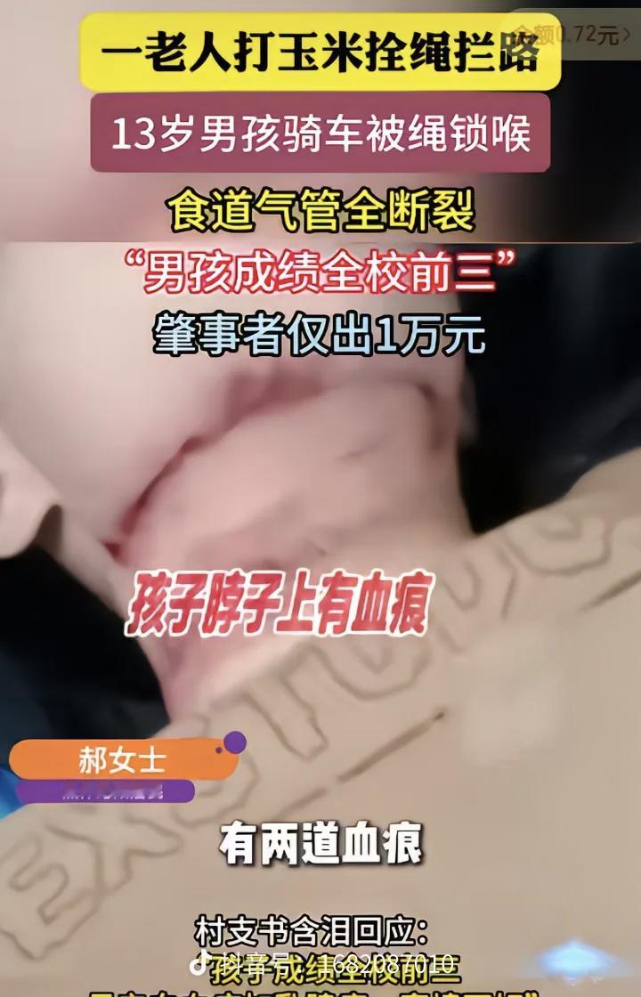 河南13岁男孩被“割喉”的事，终于有了让人宽心的进展！

孩子已经转到了北京儿童
