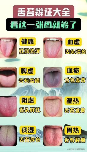 看看自己的舌头像下面哪一个？自己对号入座吧！

#健康科普##中医##中医养生#