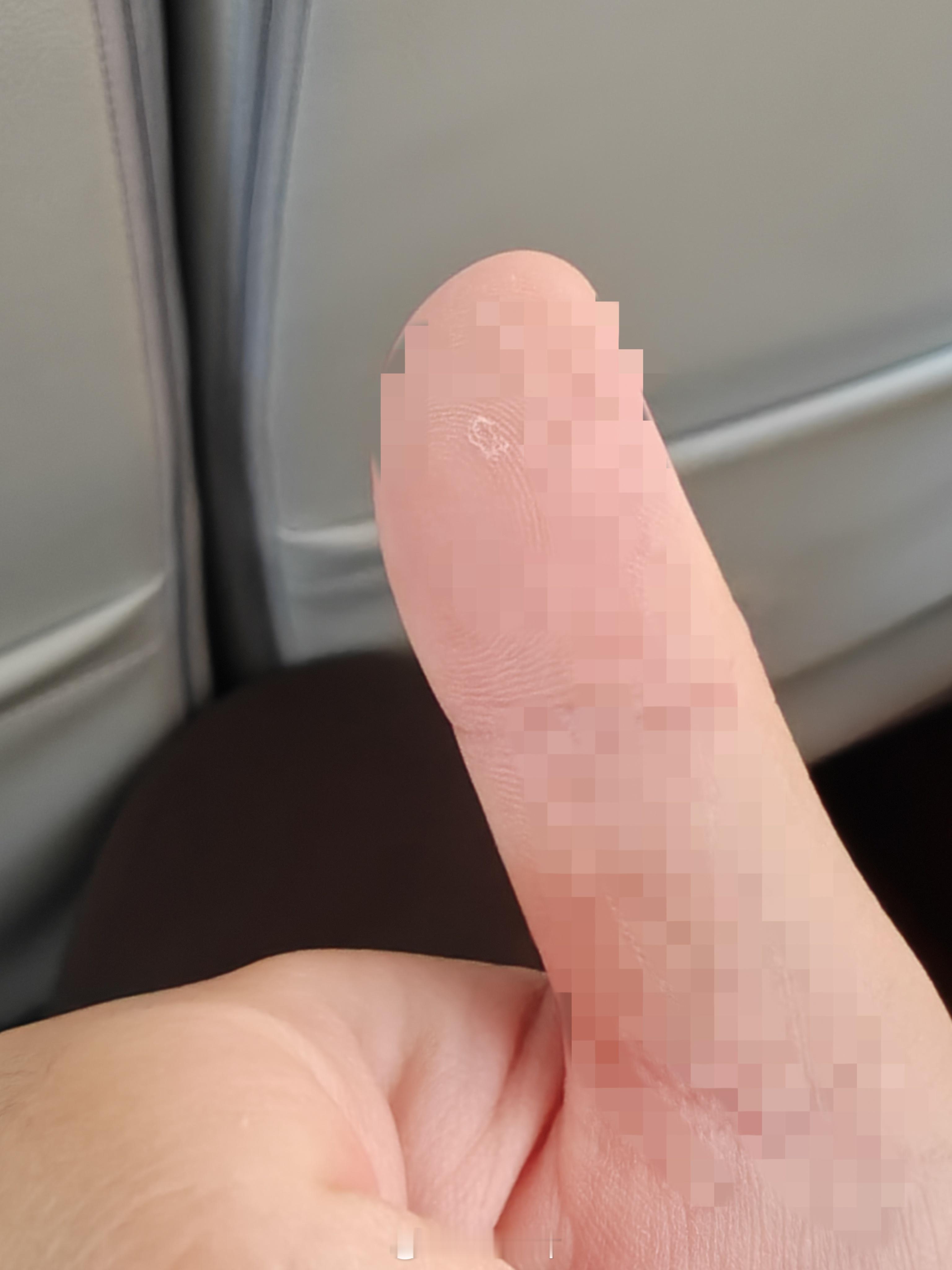 外卖订书钉什么时候可以灭绝上次单手拿外卖，就碰到了订书钉，然后不出意外的受伤了，