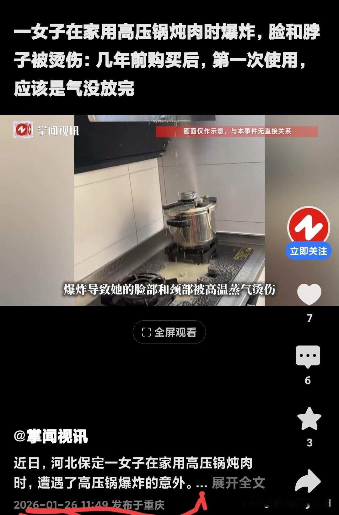 近日，河北保定一女子，
在家用高压锅炖肉。
高压锅突然爆炸，
这锅是几年前买的，
