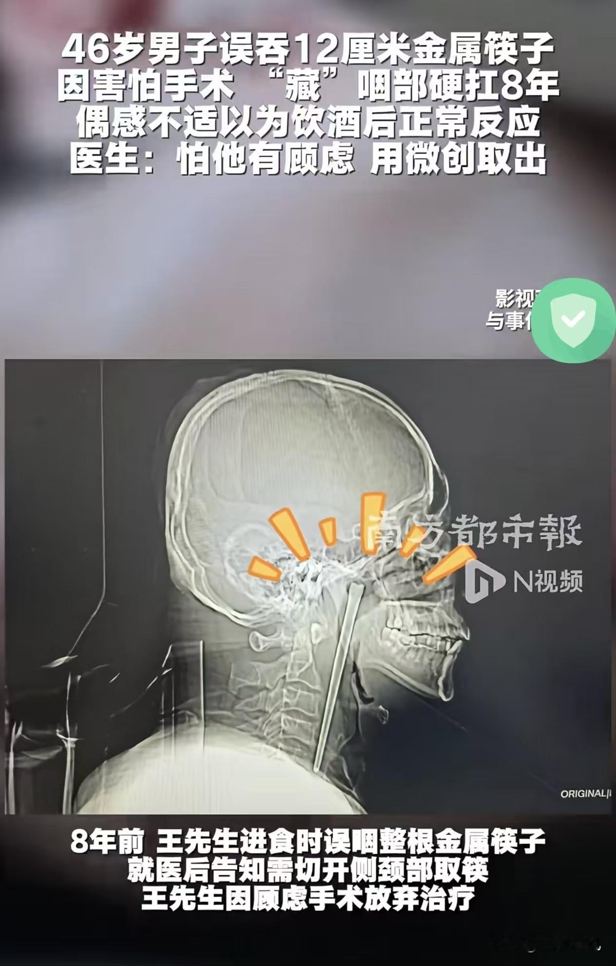 这哥们也太强了，我严重怀疑他这8年没想任何人低过头[捂脸]