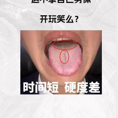出现这样的舌象，再继续吃 “ 知柏地黄丸 ”，简直拿自己身体 “ 开玩笑 ”

