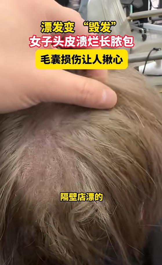 “太吓人了！”近日，上海，一女子去理发店染发，理发师掀开她的头发发现，她里面的头
