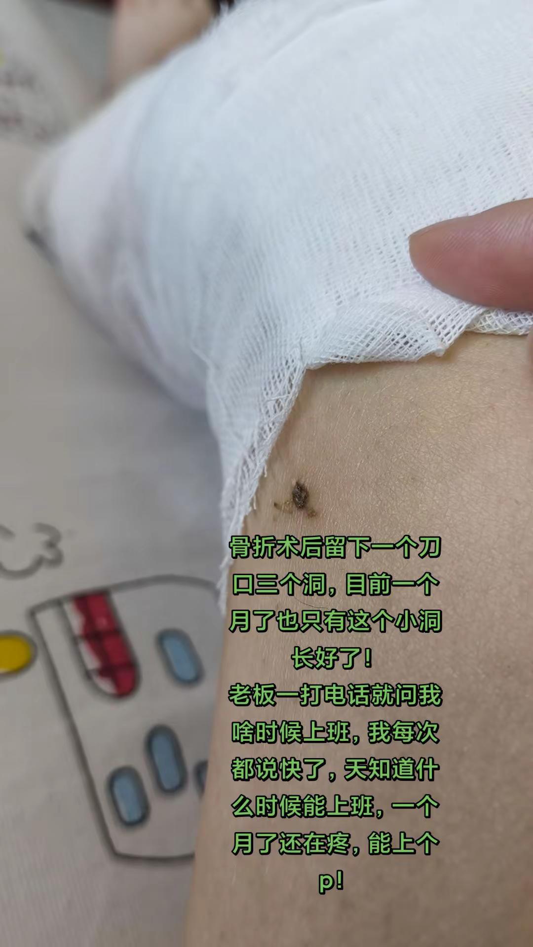 一个月了，里面外面都还在疼，伤口也没长好，正常吗？