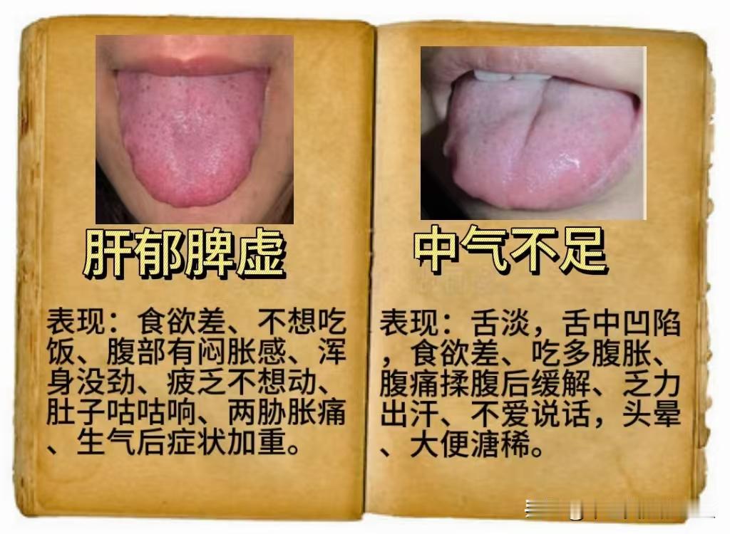 中医教你30秒内分清：肝郁脾虚和中气不足，脾胃虚寒和脾虚气滞！