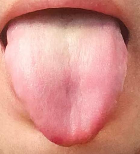 气血亏虚兼瘀堵，功能状态易受影响；补血通瘀，找回理想状态






有不少男同