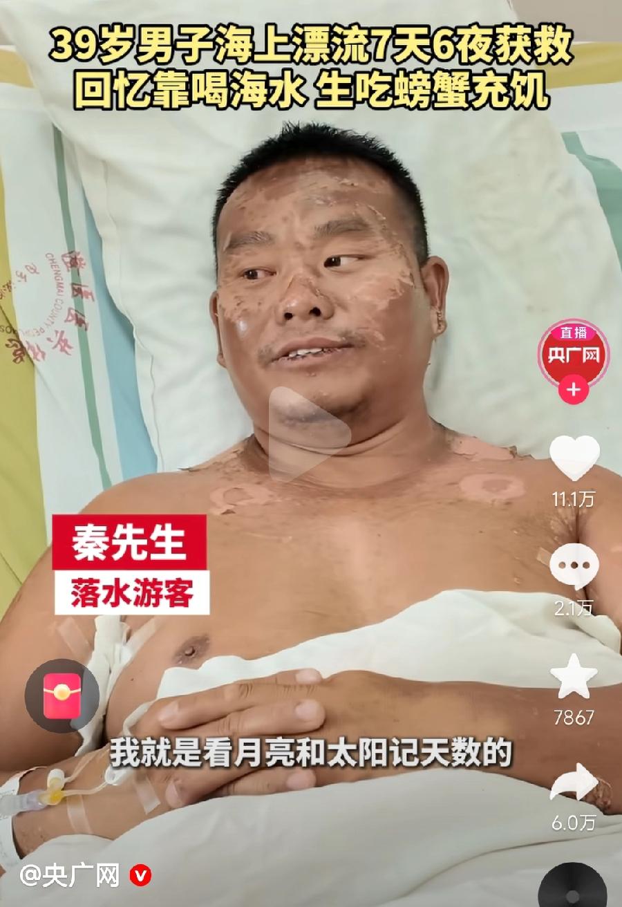 海上漂浮7天6夜秦先生，浑身皮肤表皮脱落，千疮百孔，被太阳晒得、被海水泡得，像被
