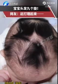 离谱实拍！宝妈晒娃头顶竟长 9 个发旋瞬间走红全网，浙江宝妈 5 月 11 日分