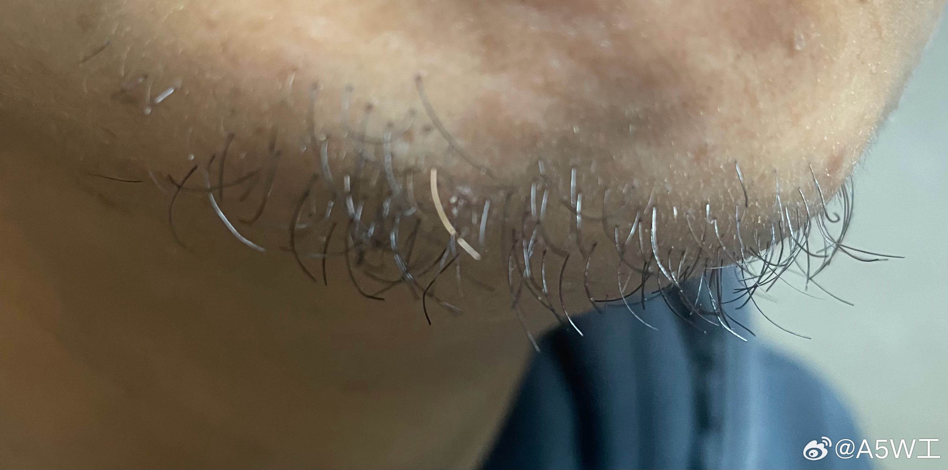 今天突然发现怎么长了一根金色的胡子🧔🏻，是我要老了还是这还有点老外的基因呢。