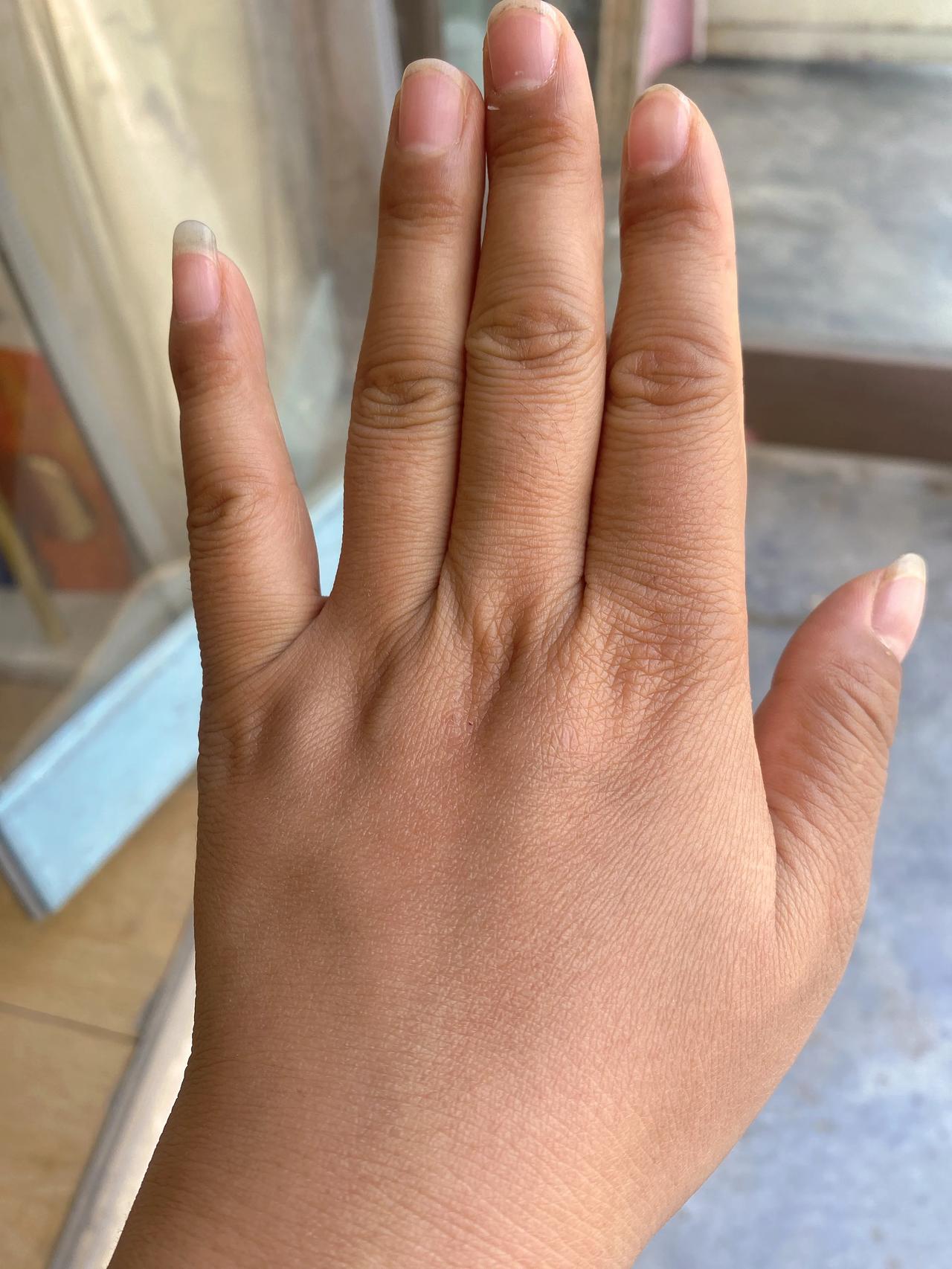我是一个女生，竟然长了一双粗大的手。