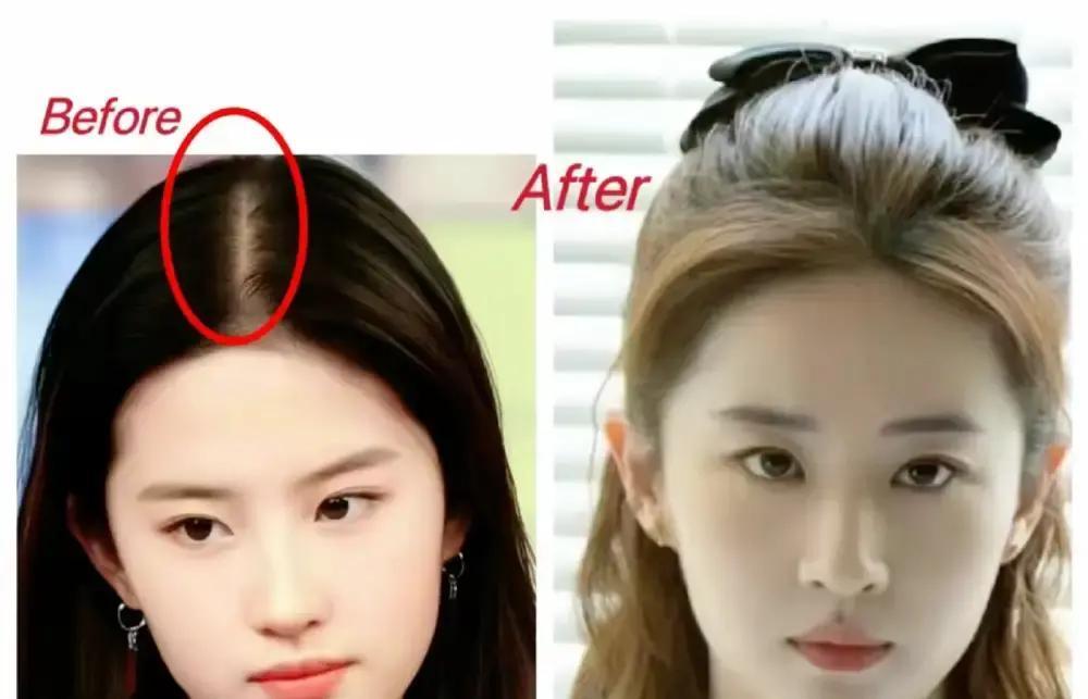 15万，够我老家一家人吃两年。

刘亦菲那顶假发就这个价，瑞士手工的。网上又翻出