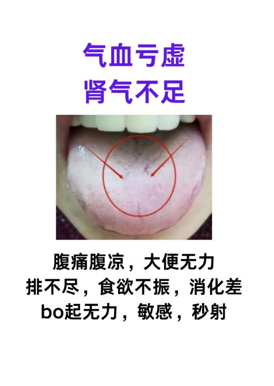 身体有这些不适？舌象藏着你的脏腑问题