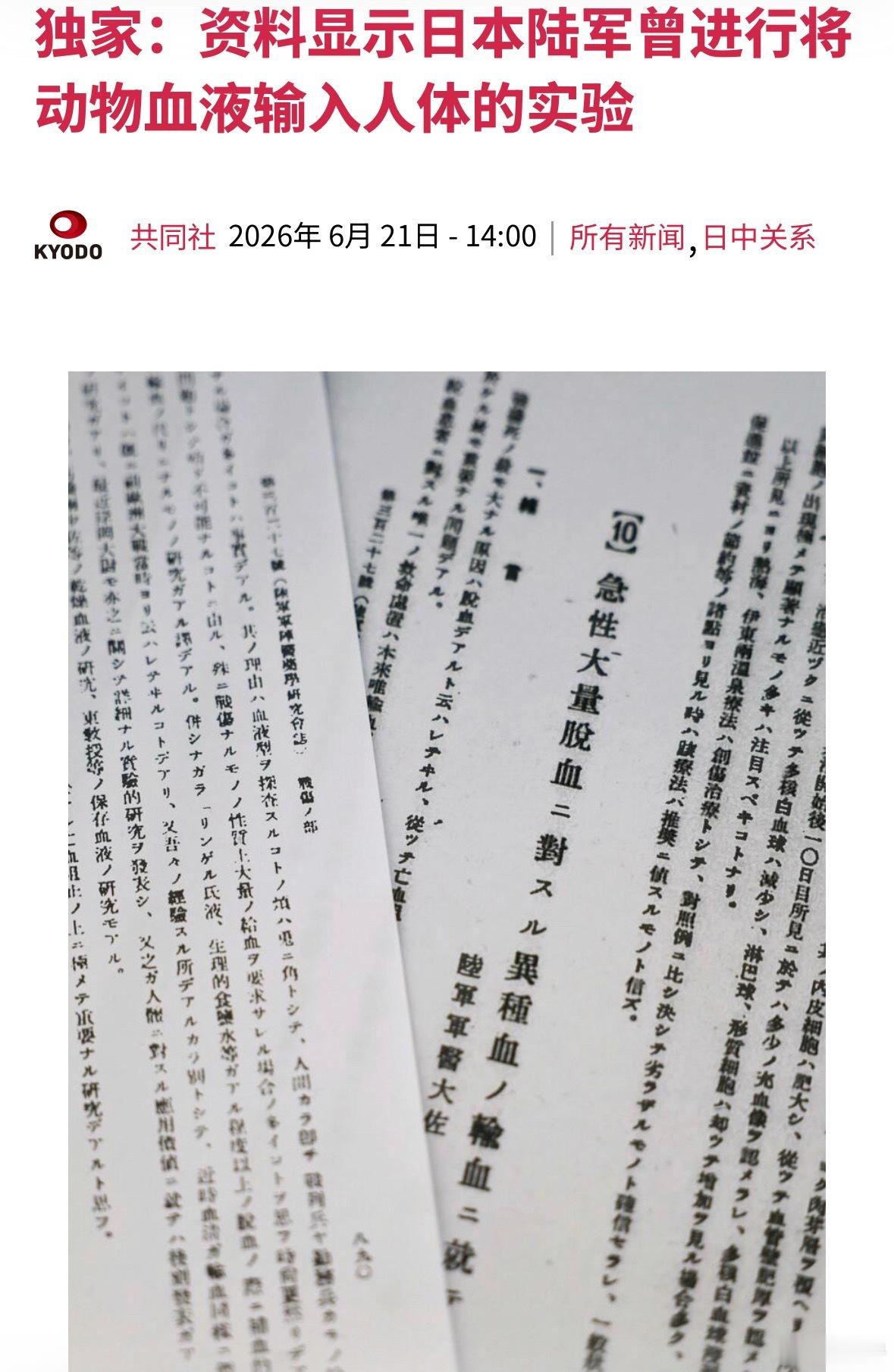 侵华日军曾实施输马血人体实验这个实验是在1938年秋天的某个时间做的，在1940