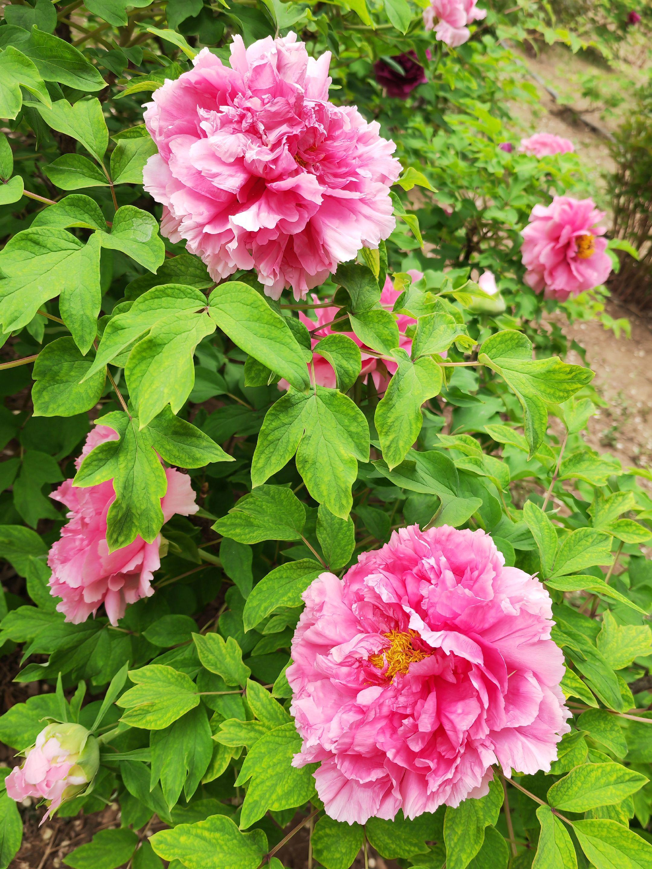 脊神经节段皮肤分布。