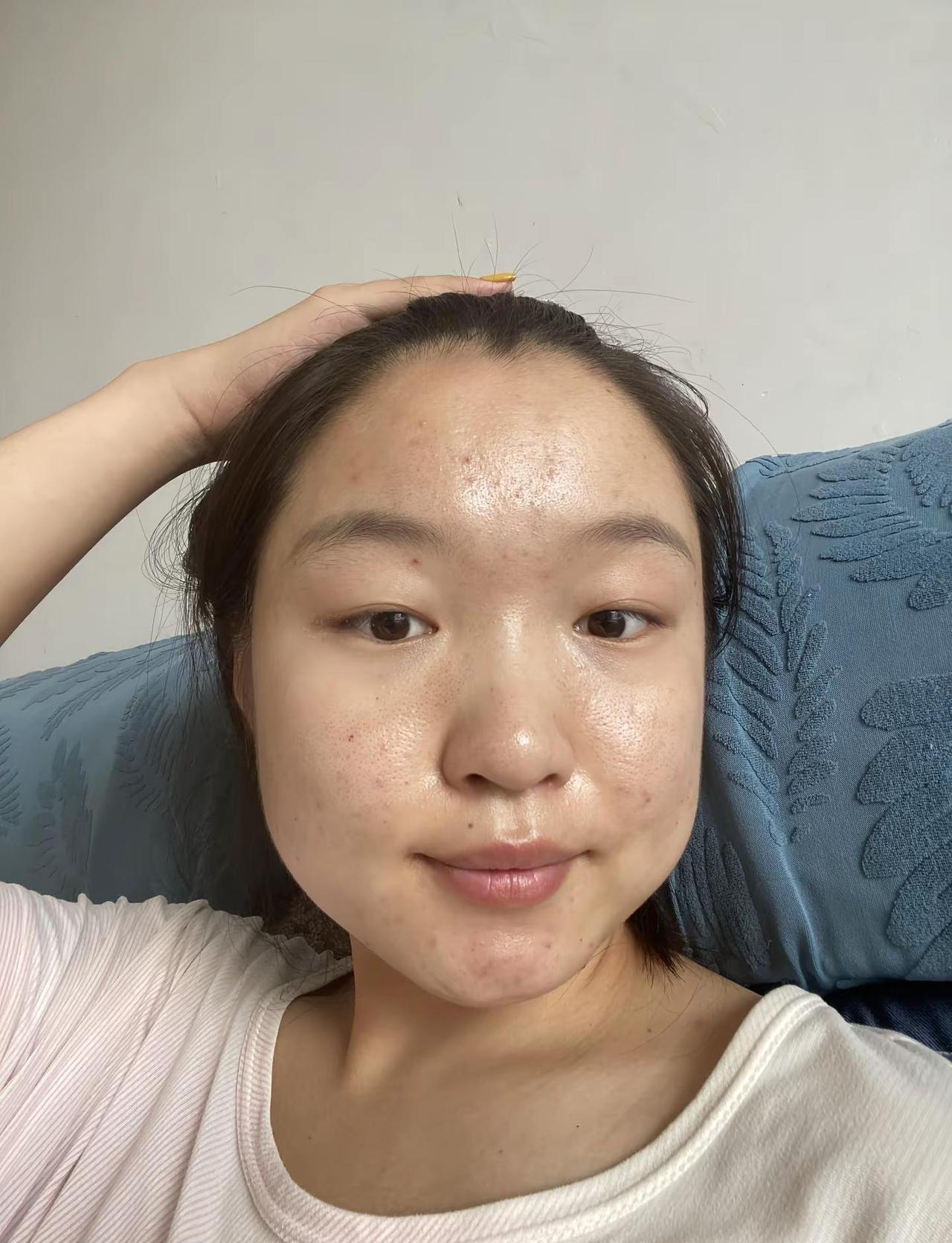 幸福是形容不出来的 我发现脸上的痘好了很多 曾经让我耿耿于怀的事似乎也不那么计较