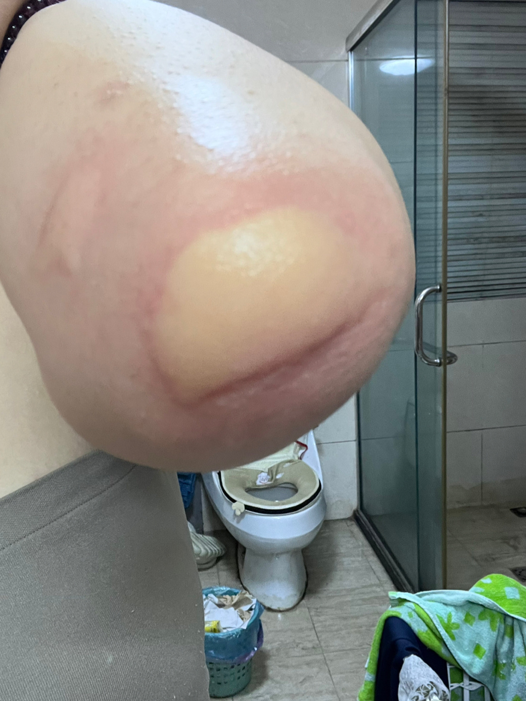 遇到了一辈子没吃过饭的蚊子 ​​​