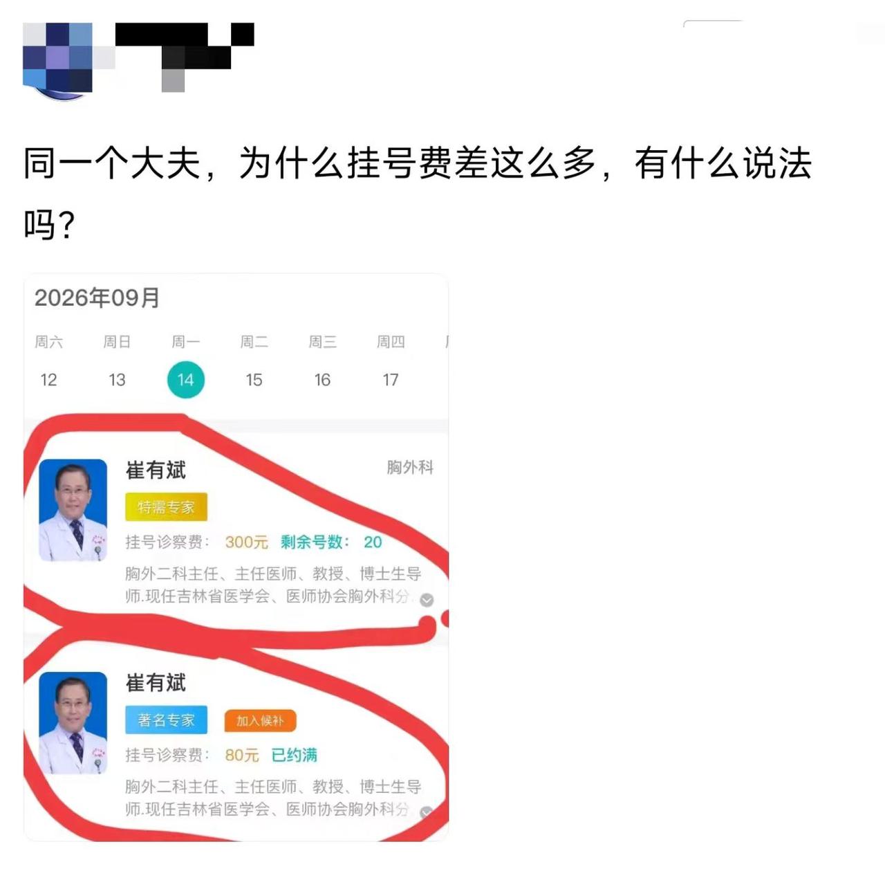 这差价，是服务不一样吗？