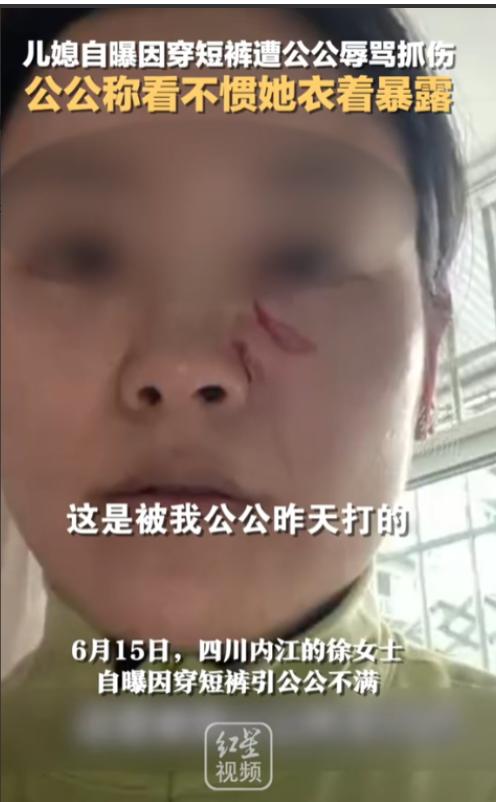 “清官难断家务事！”四川，一儿媳因天气热穿了条白色短裤，竟被50多岁的公公指着鼻