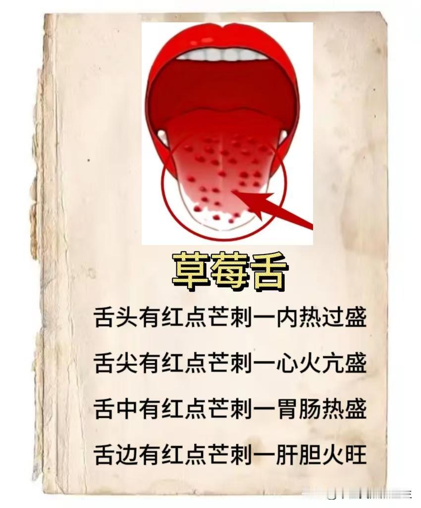 舌头就像身体的一面镜子，透过它，能看出五脏六腑的健康状况，草莓舌、裂纹舌、齿痕舌