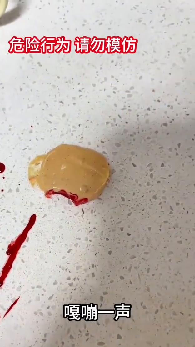 大家吃火锅的时候一定要注意，我还以为这是土豆片，嘎嘣一声才发现原来是我的眼镜片，